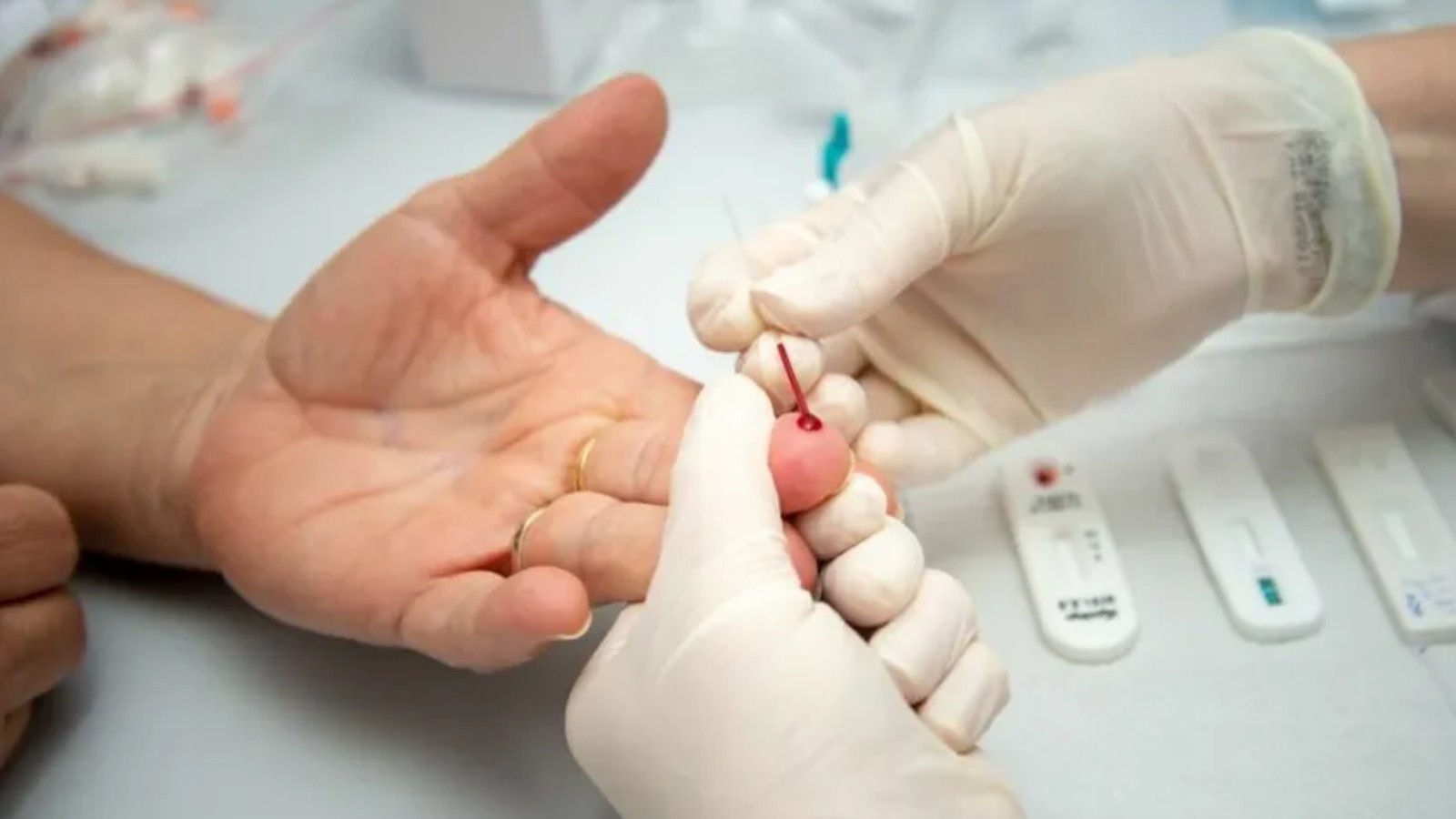 
Após o carnaval, Teresina reforça importância de testes gratuitos de HIV e outras ISTs; veja onde fazer