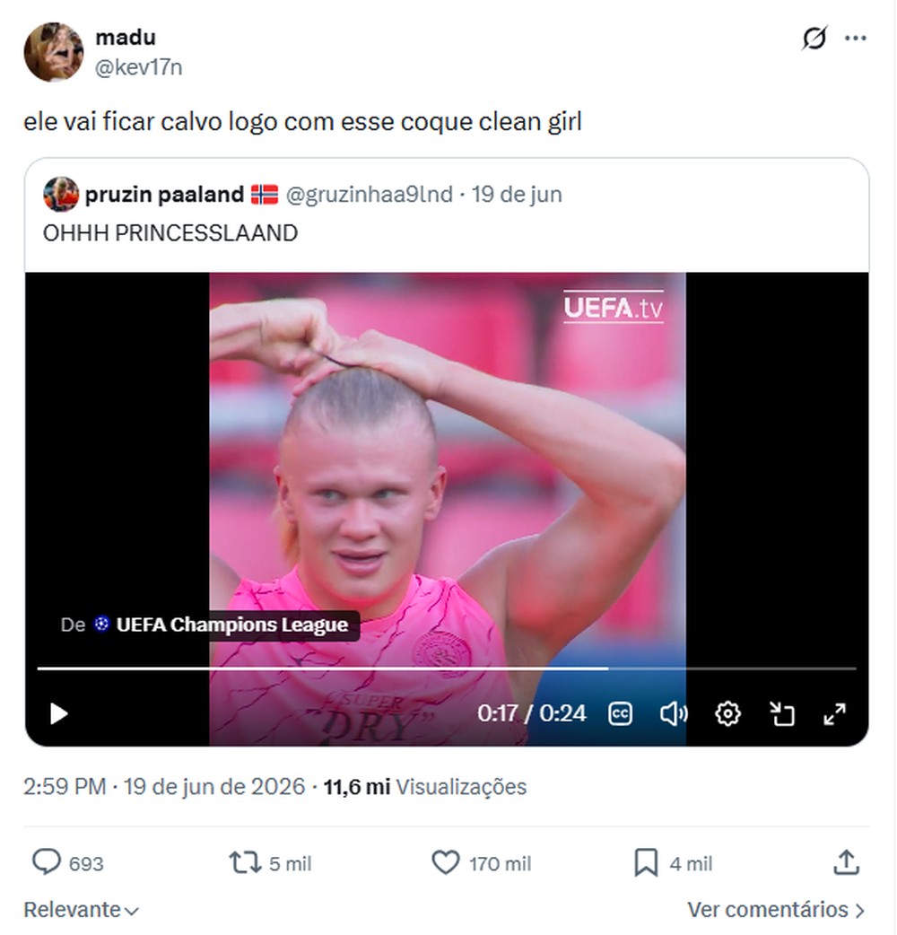 Penteados com tensão excessiva podem causar alopecia de tração e a perda definitiva de cabelo