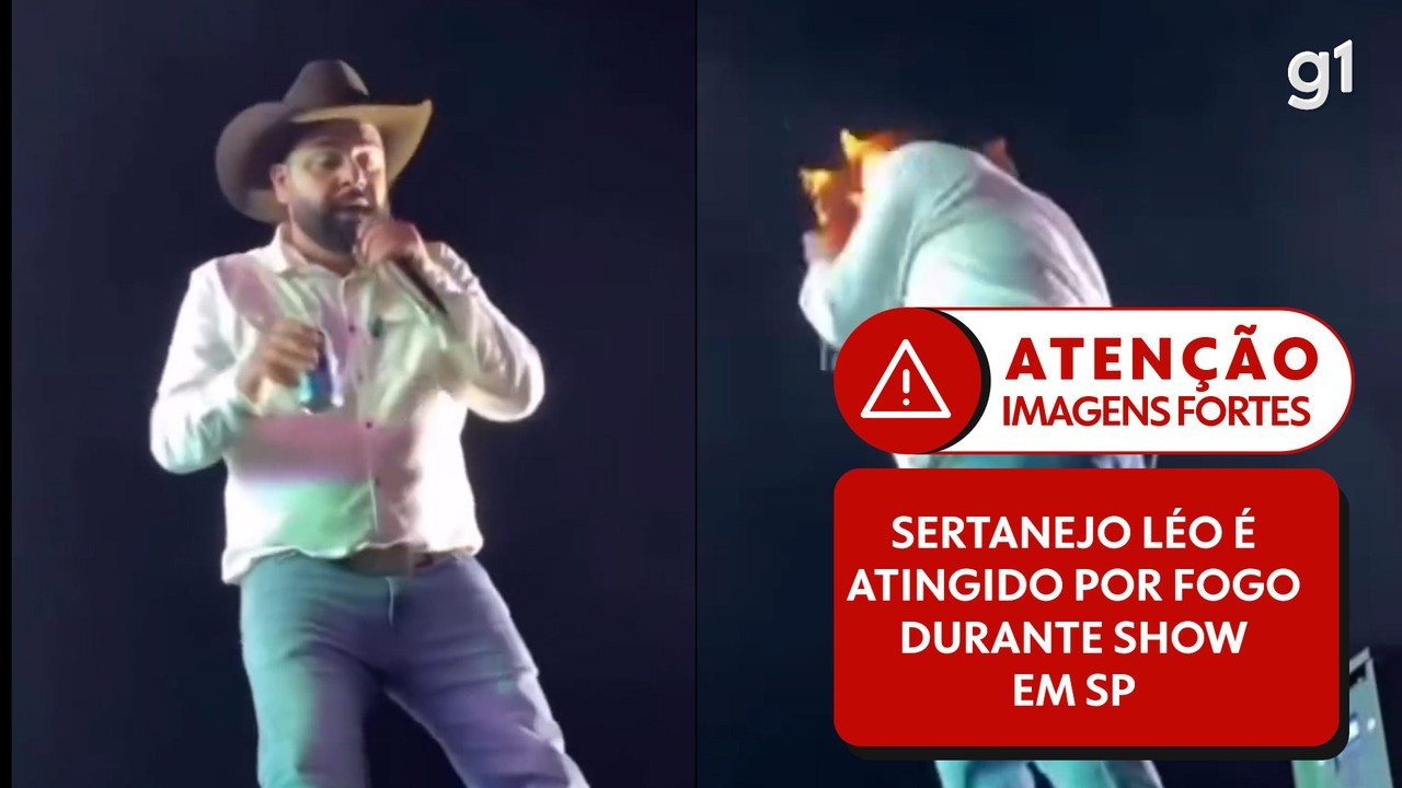 Sertanejo Léo fica ferido ao ter rosto atingido por fogo de máquina de efeito especial em show; vídeo