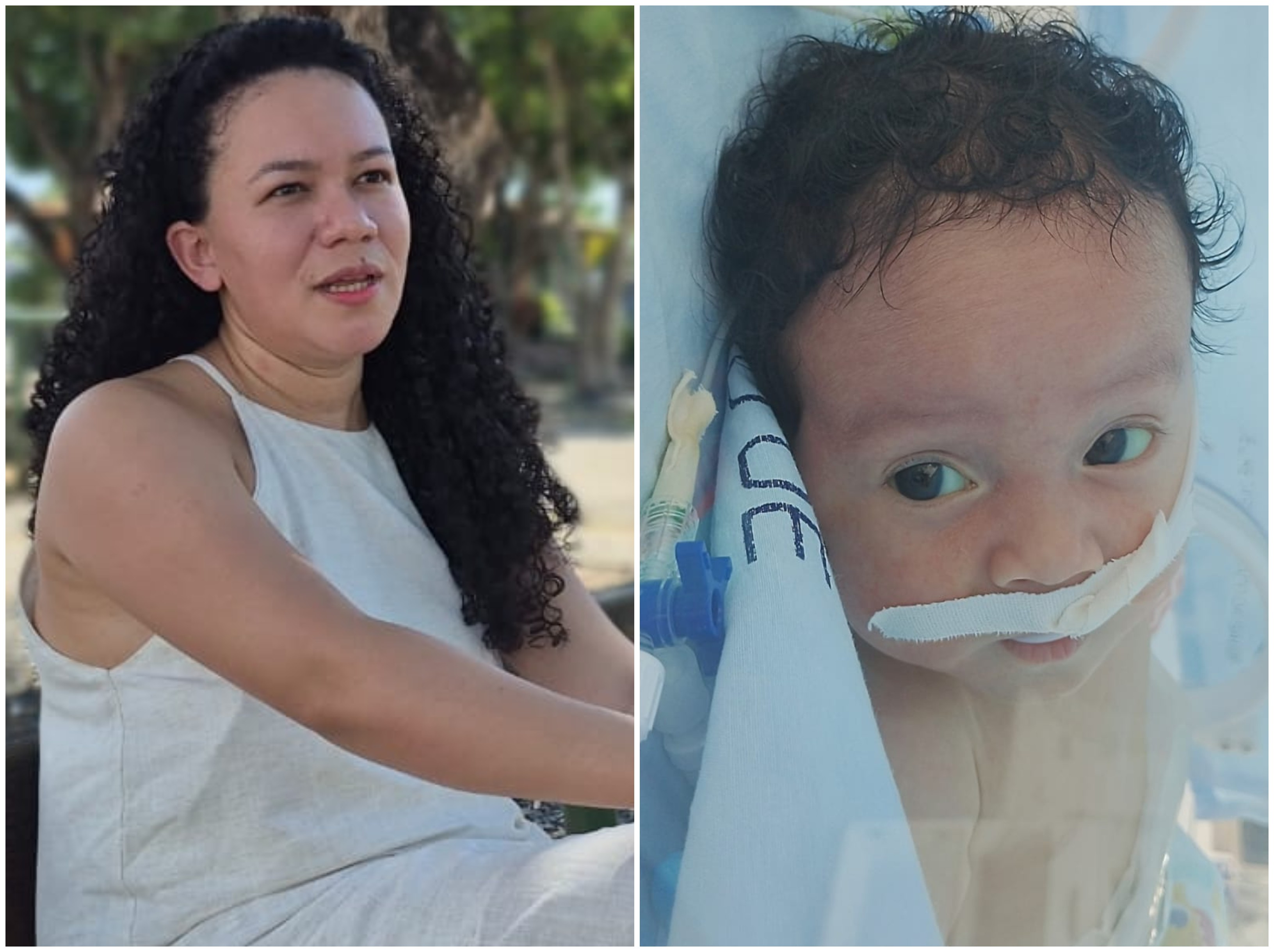 Mãe cobra agilidade no TFD para bebê com doença intestinal que precisa de cirurgia fora de Roraima