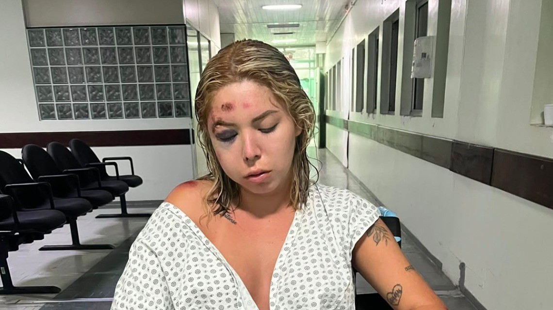 'Não queria o dinheiro, queria realmente brigar', diz jovem que fraturou rosto após discussão com motorista de app em Florianópolis 