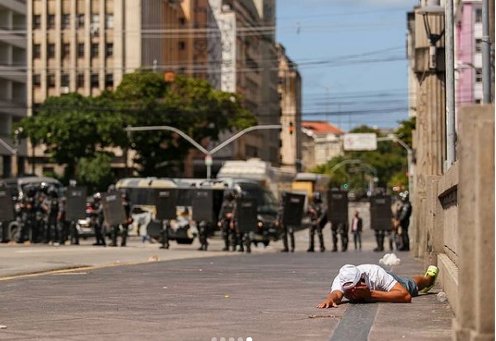 G1 - Jovem que perdeu visão de um olho após explosão recebe alta