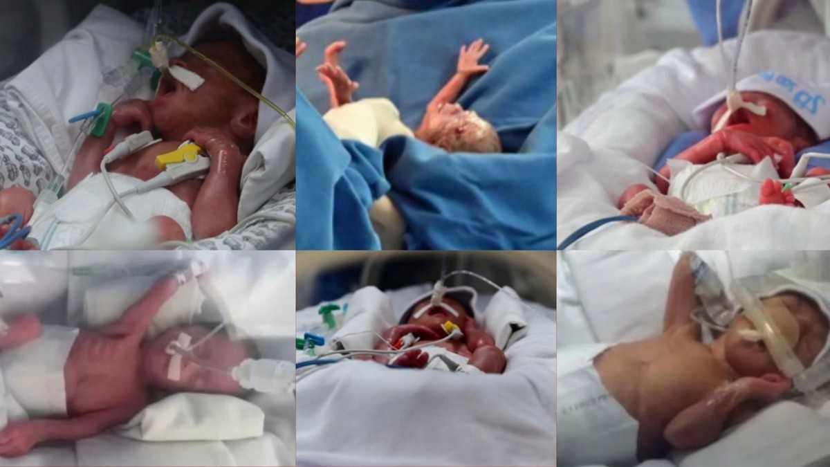 Mãe de sêxtuplos do ES divulga fotos e comenta estado de saúde dos bebês