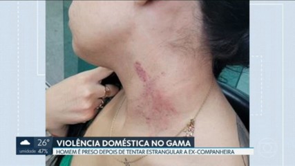 VÍDEOS: DF2 de segunda-feira, 17 de  fevereiro de 2025 - Portais