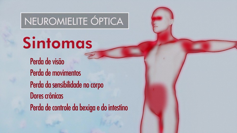 Sintomas incluem dores crônicas — Foto: Reprodução/RBS TV