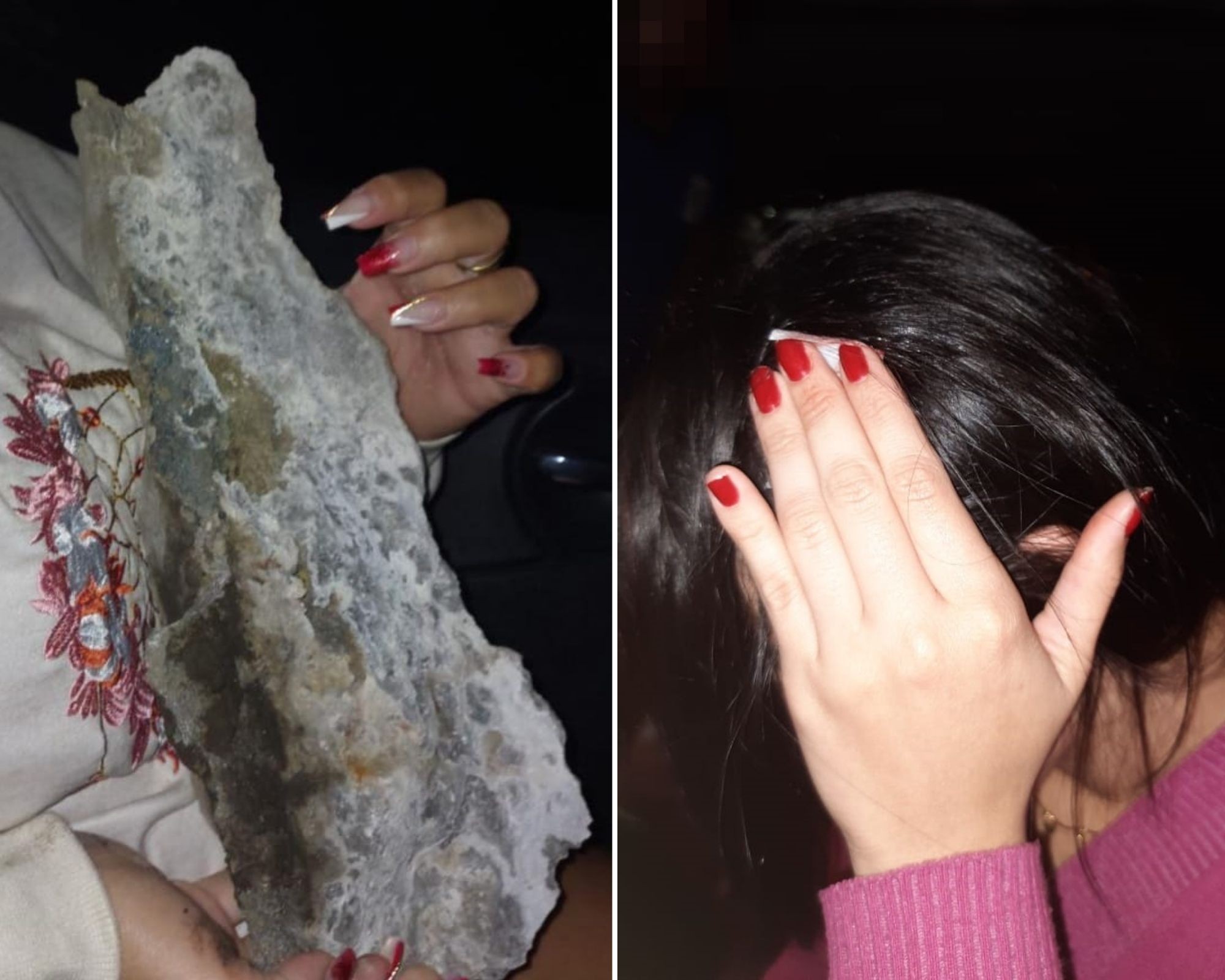 Jovem atingida na cabeça por bloco de concreto durante travessia de catraia recebe R$ 20 mil de indenização