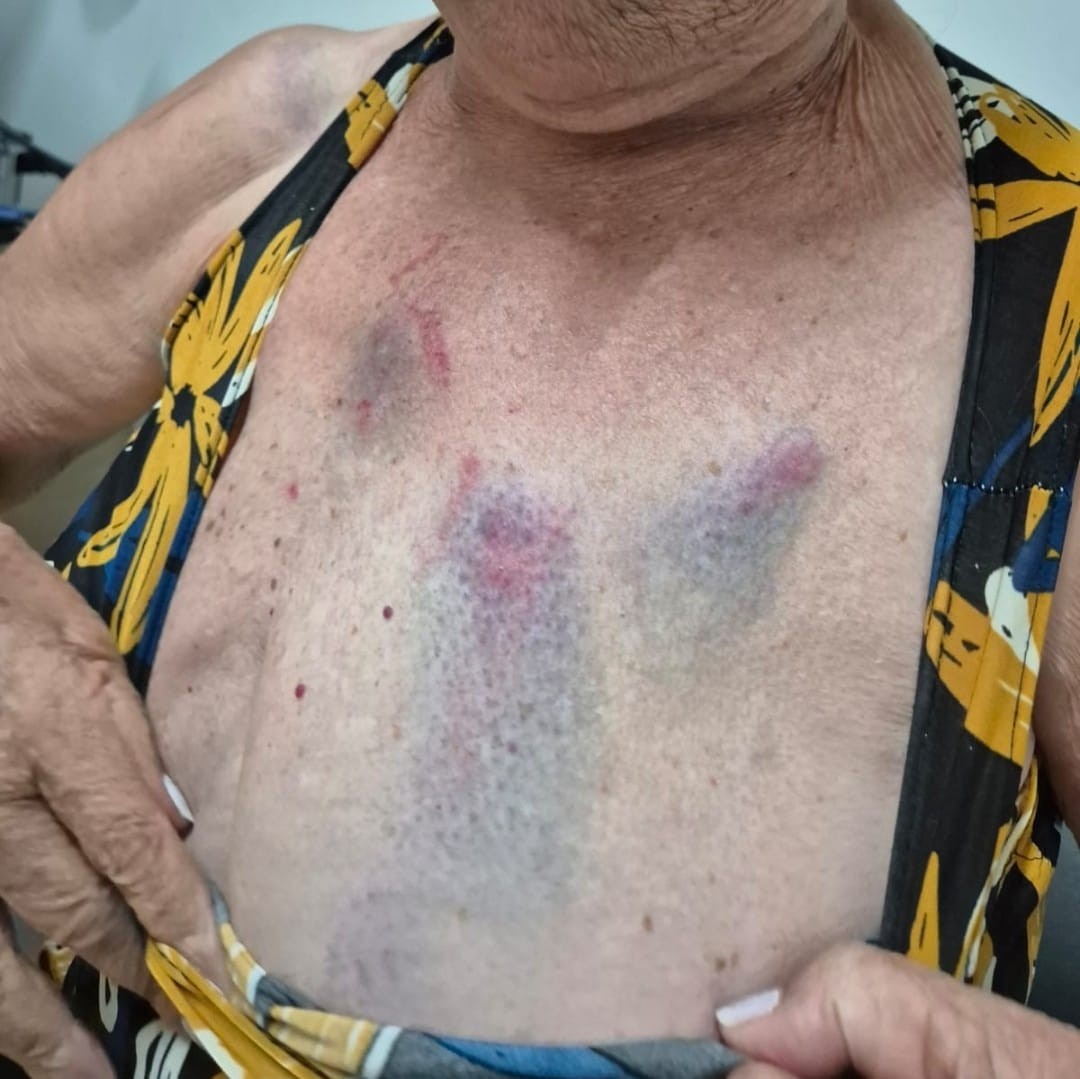 Médica agride tia idosa pela segunda vez e é presa em flagrante em Arapiraca