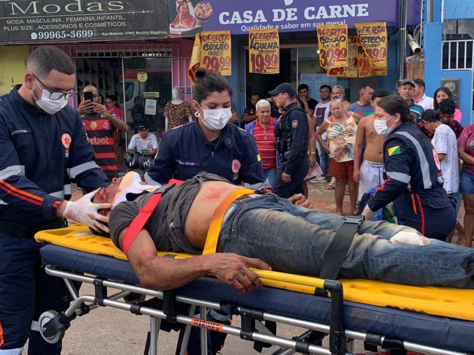 Homem é atropelado por motociclista sem habilitação em Rio Branco