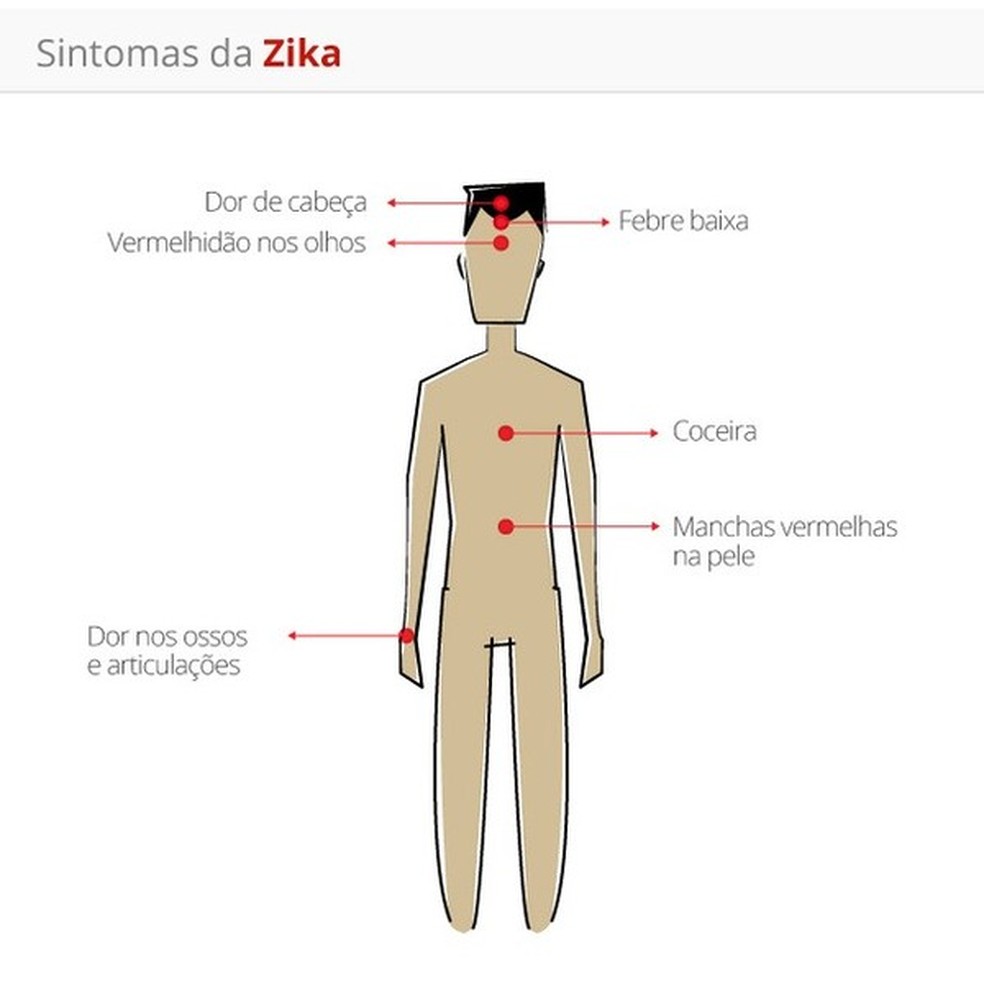 Sintomas da zika — Foto: g1