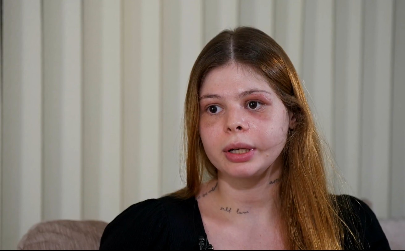 'Me sinto perdida': médica que levou socos no rosto relata dificuldade em lidar com marcas da agressão