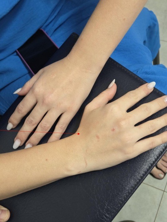 Braços e mãos com ferimentos — Foto: Reprodução