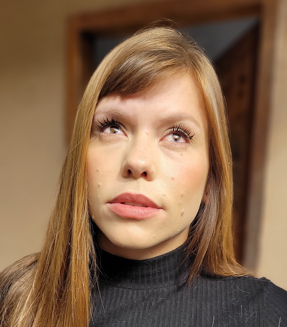 Anelize Kloster, de 29 anos, tem síndrome do olho de gato — Foto: Eduardo Andrade/RPC