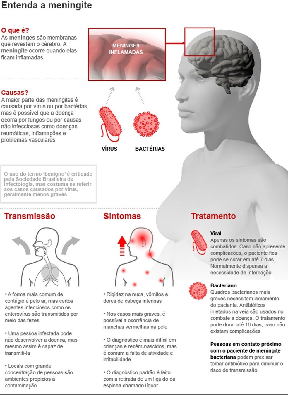 Entenda a meningite &mdash; Foto: Arte/G1/Arquivo