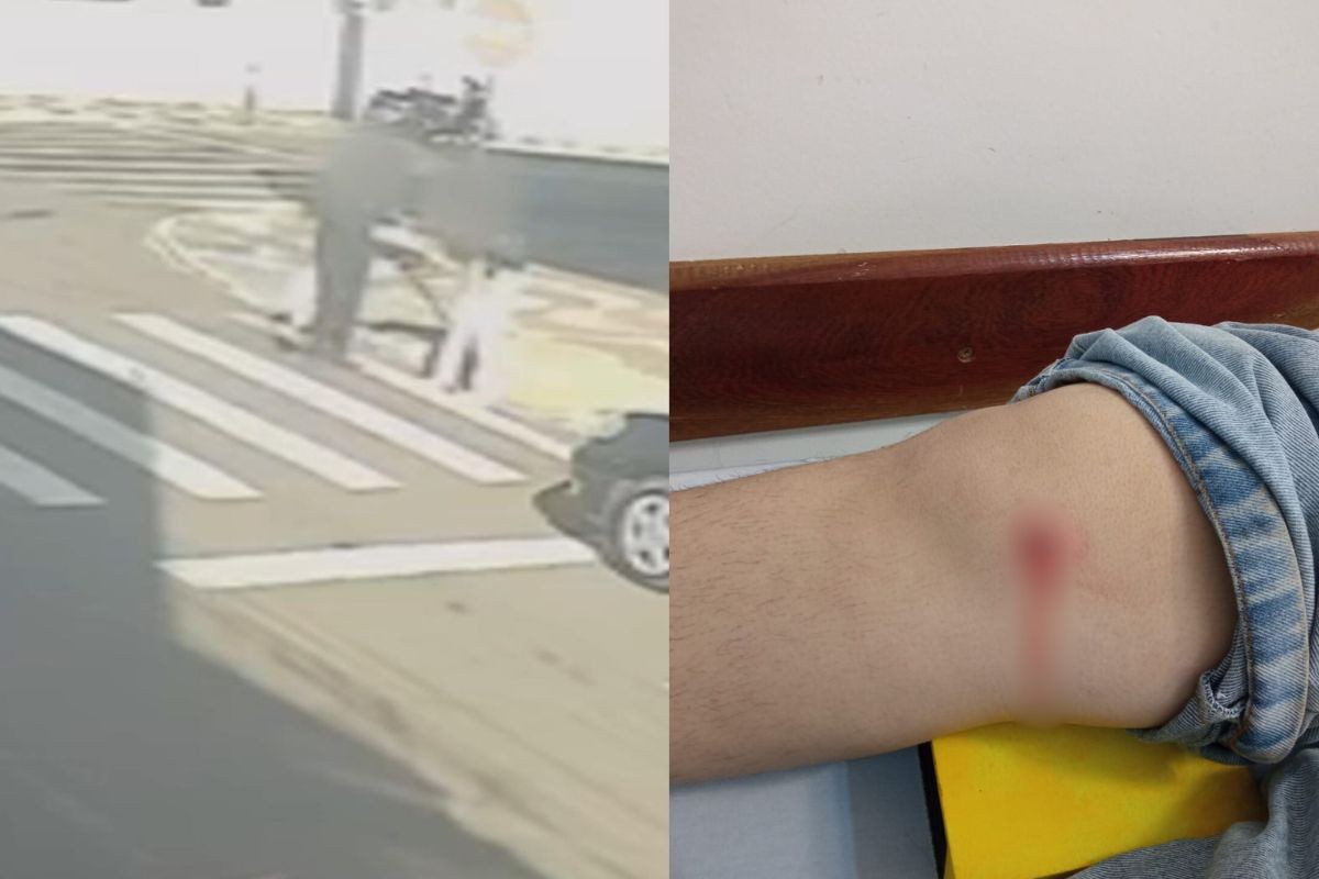 
Adolescente é atingida por bala perdida no joelho enquanto atravessava rua no Paraná