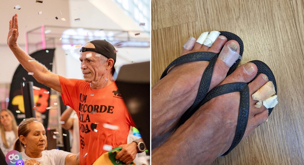 Antonio Jussier Damasceno percorreu 920 km em sete dias de desafio na corrida em esteira e chegou a correr descalço por causa de ferimentos nos pés. — Foto: Arquivo pessoal