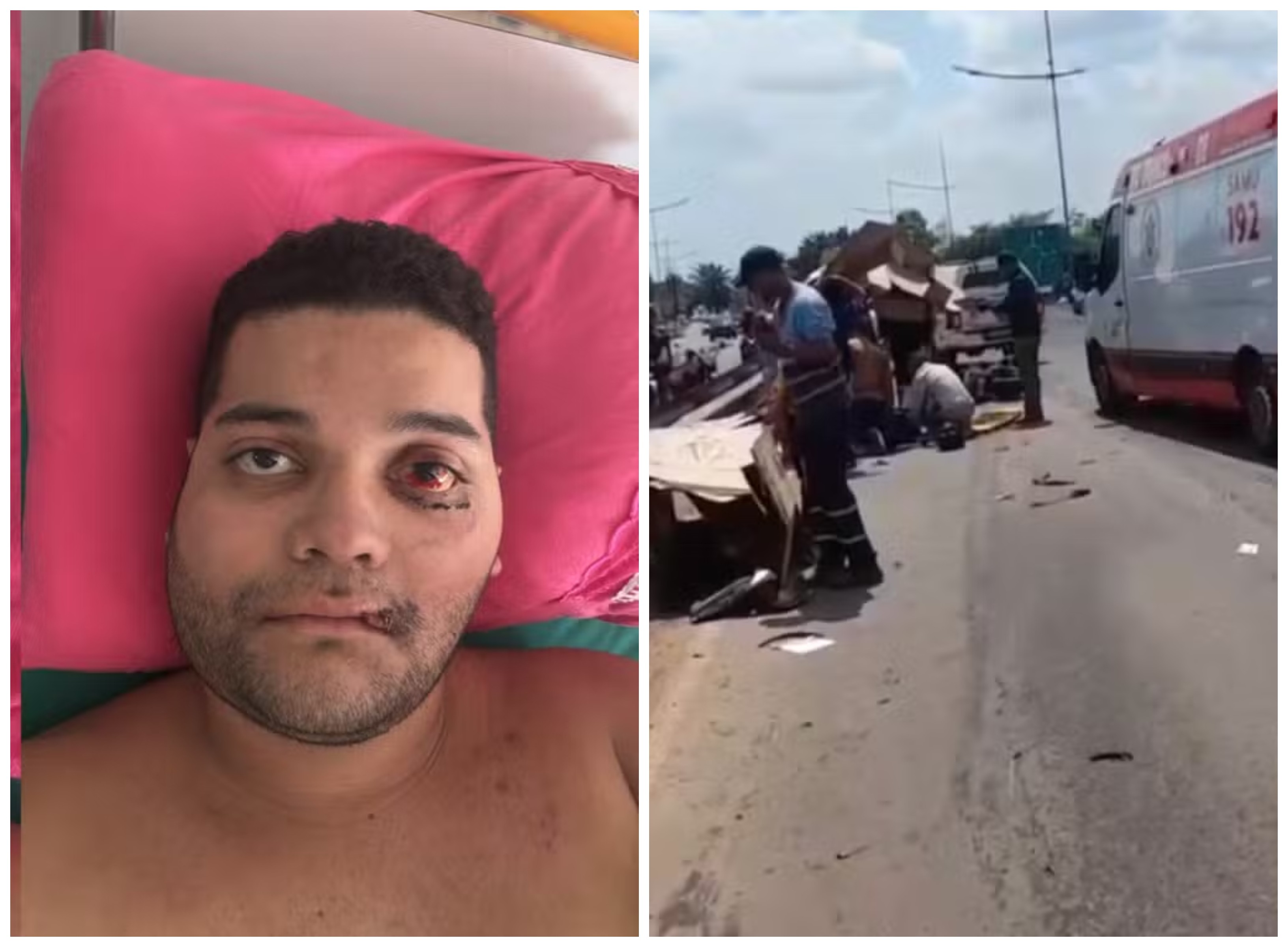 Motociclista envolvido em acidente na BR-364 fraturou rosto e bacia; vítima segue internada
