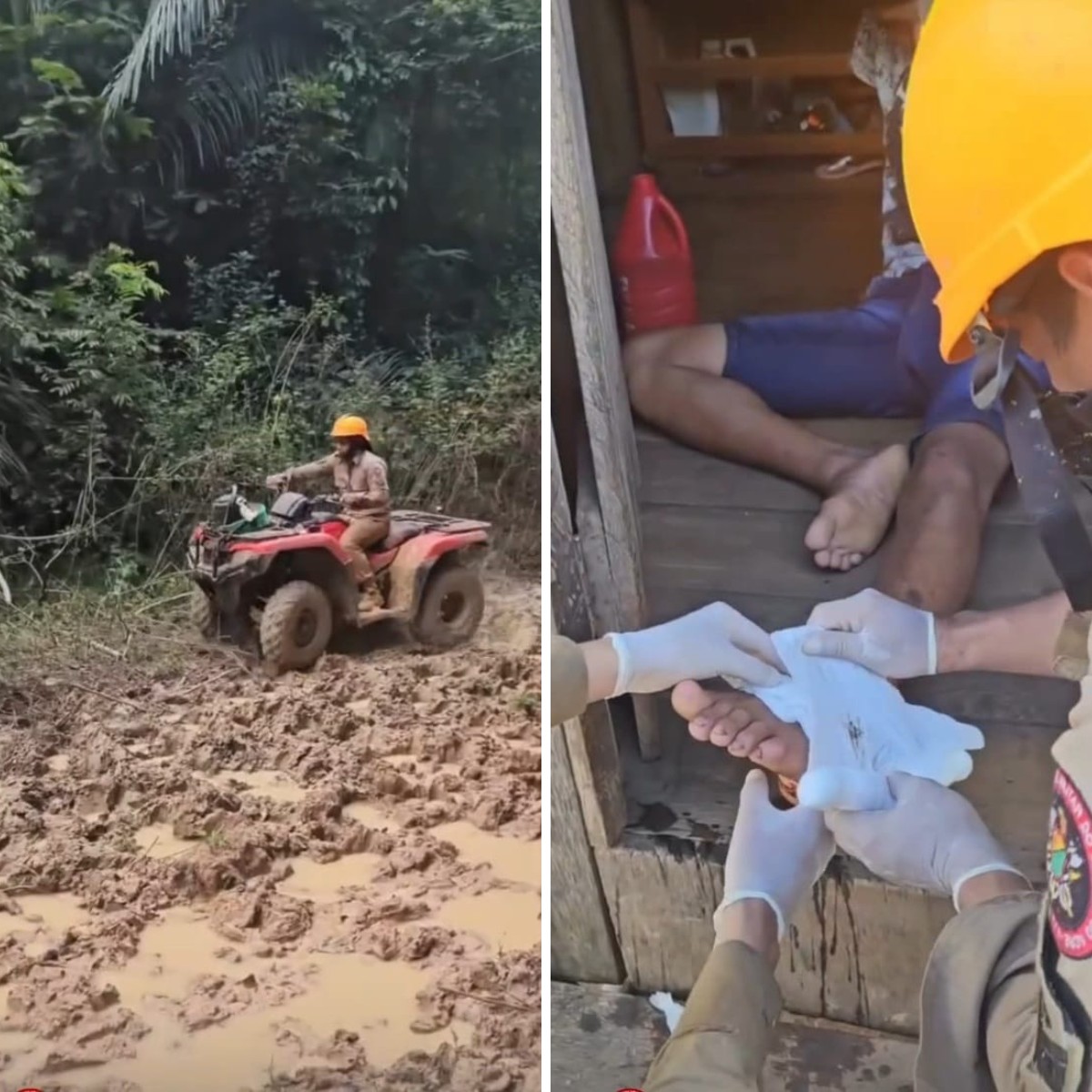 Após 24h, homem que se feriu com motosserra é resgatado por bombeiros em local de difícil acesso no AC; vídeo mostra operação