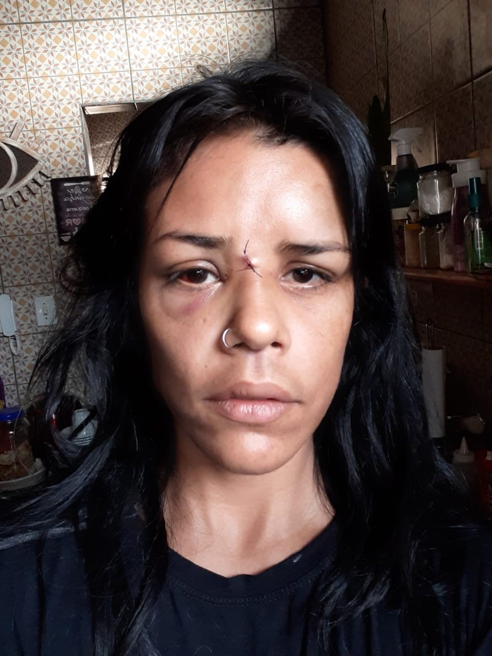 Artesã pegou dois pontos no rosto e ficou com vários hematomas após agressões — Foto: Arquivo pessoal