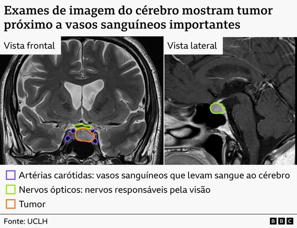 Exames de imagem do cérebro. — Foto: BBC