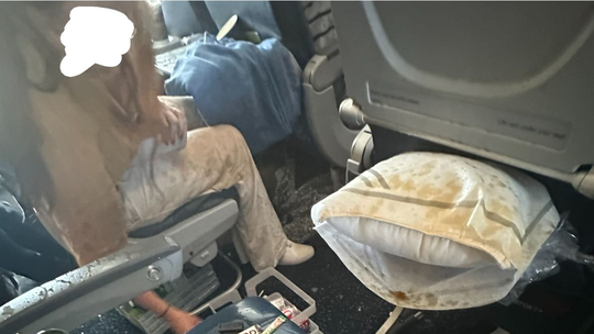 Passageiro mostra caos na cabine de voo onde 25 ficaram feridos após forte turbulência nos EUA - Aeronave da Delta saiu de Salt Lake City, em Utah, e tinha destino em Amsterdã, na Holanda, mas teve que pousar em Minneapolis. Passageiros foram hospitalizados, segundo companhia aérea.