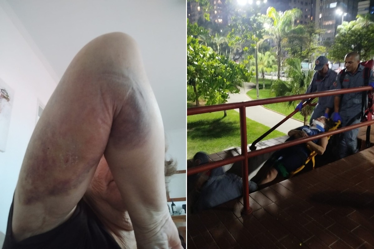 Guarda-corpo cede e mulher cai de escadaria durante exercício na orla de Santos
