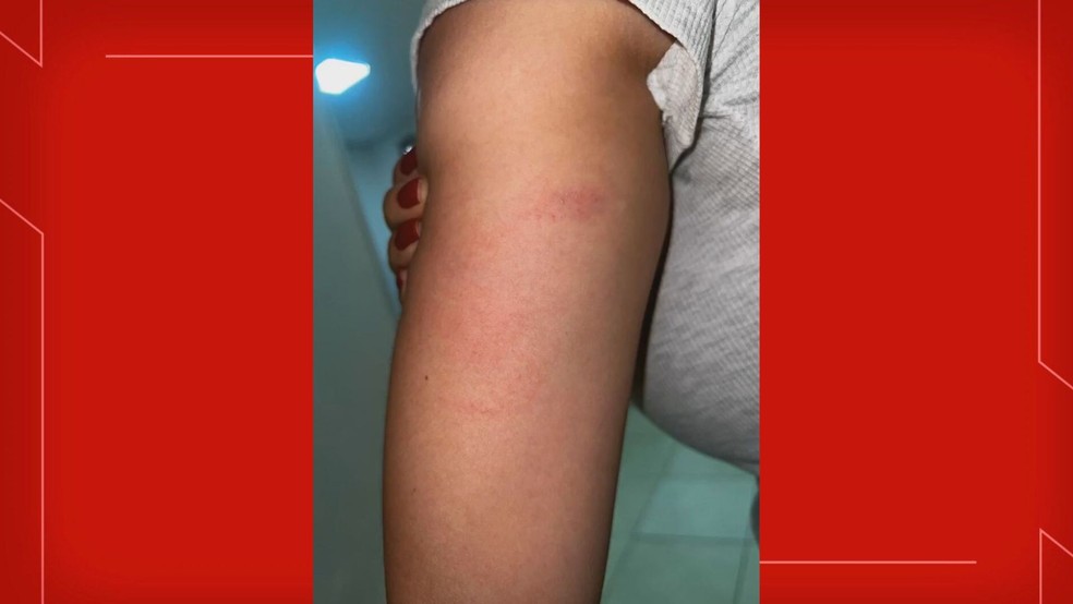 Mulher é agredida por bombeiro durante briga em condomínio no DF — Foto: Arquivo pessoal