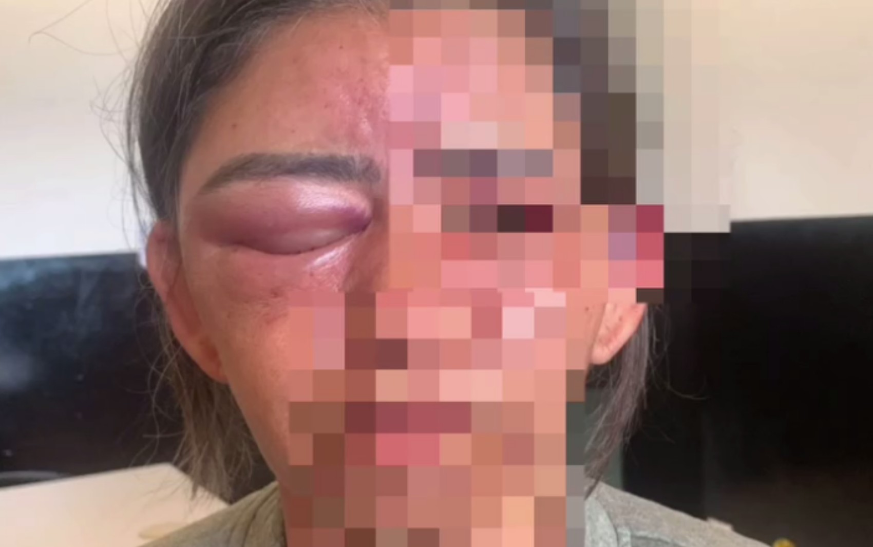 Mulher é estrangulada e espancada até desmaiar por amigo do filho, em Goiás