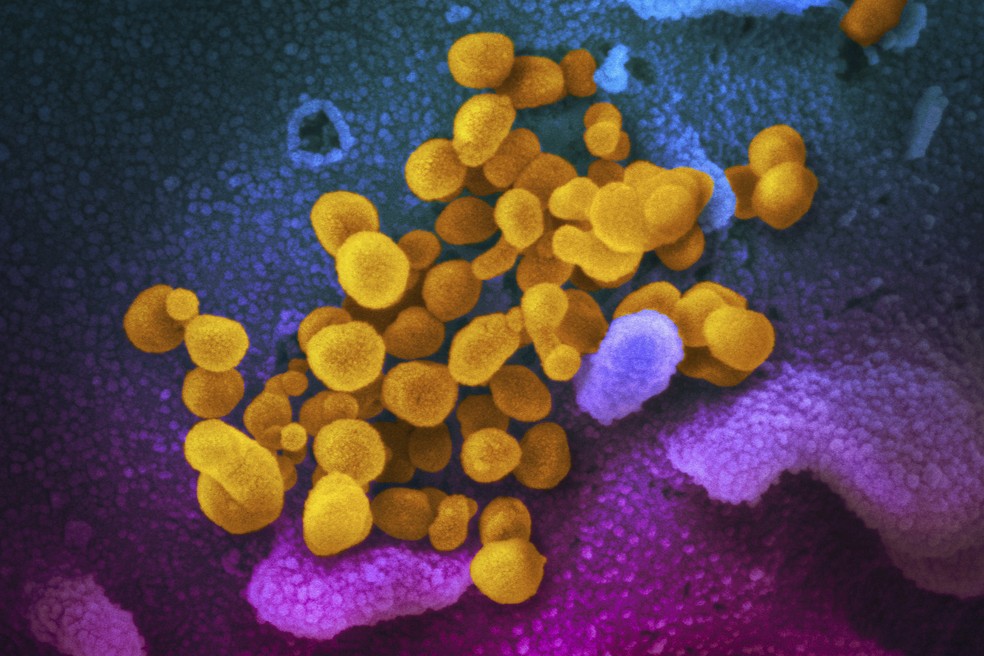 Imagem ilustrativa não-datada mostra o Sars CoV-2, indicado em amarelo, emergindo da superfície de células, indicadas em azul/rosa. — Foto: NIAID-RML/ASSOCIATED PRESS