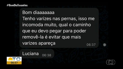 Cardiologista explica como identificar os sintomas da doença varizes