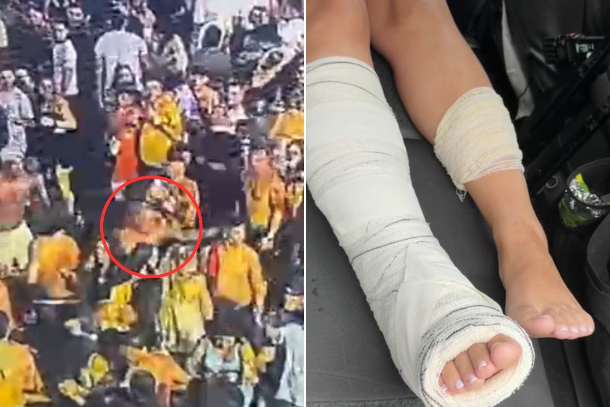 Moradora de SP baleada por PM em show de Zé Neto e Cristiano tem osso da perna atingido; VÍDEO 