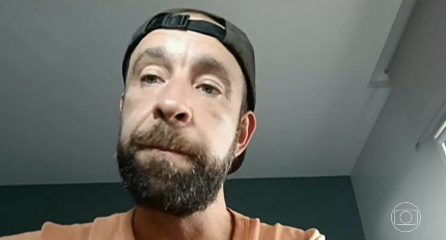 Surfista relata euforia dos médicos no momento em que coração voltou a bater após acidente com peixe