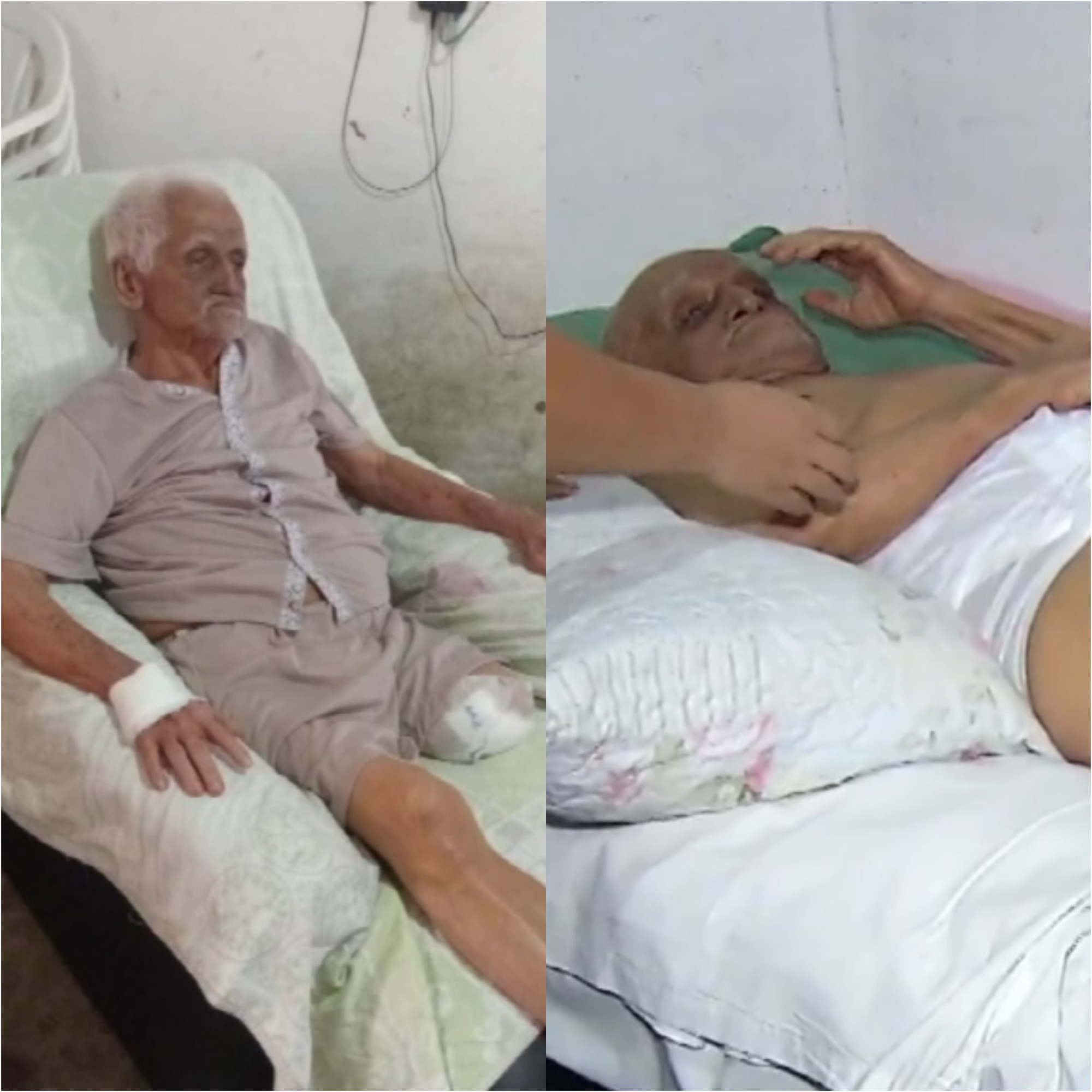 Idoso amputa 2ª perna após espera de mais de um mês em UPA por cirurgia; RN tem 46 mil procedimentos na fila