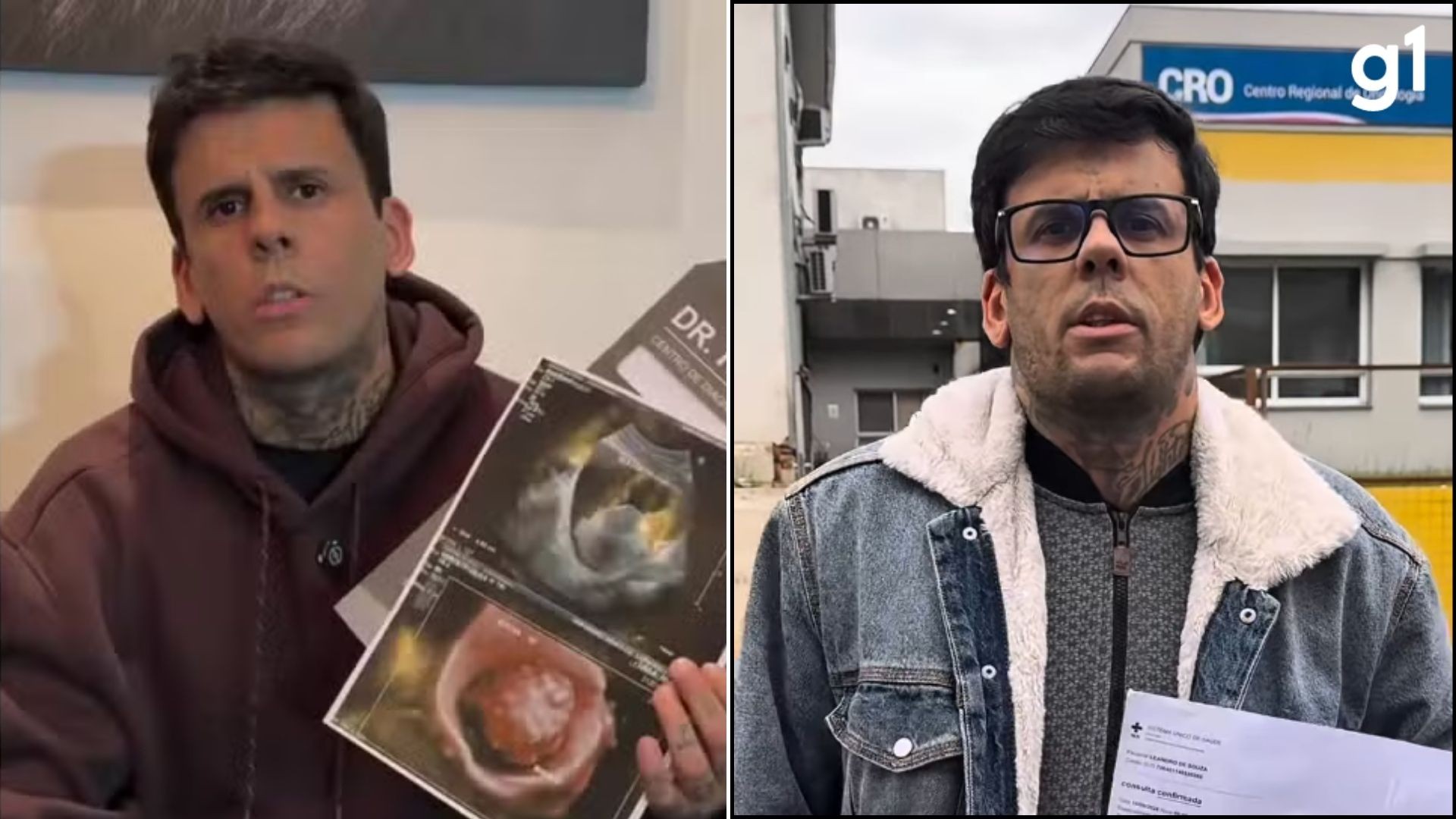 Cirurgia para retirada de tumor na bexiga do 'homem mais tatuado do Brasil' definirá se nódulo é benigno ou maligno; entenda