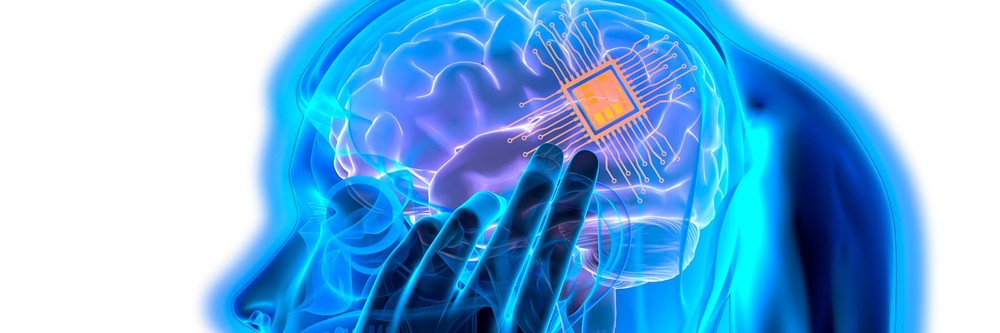 Implante cerebral permite que homem com paralisia recupere movimentos da mão após seis anos