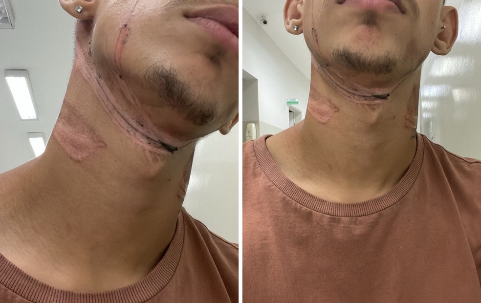 Murilo Bueno de Lima, de 21 anos, foi atingido enquanto trabalhava com entregadas em Fernandópolis (SP) — Foto: Murilo Bueno/Arquivo pessoal