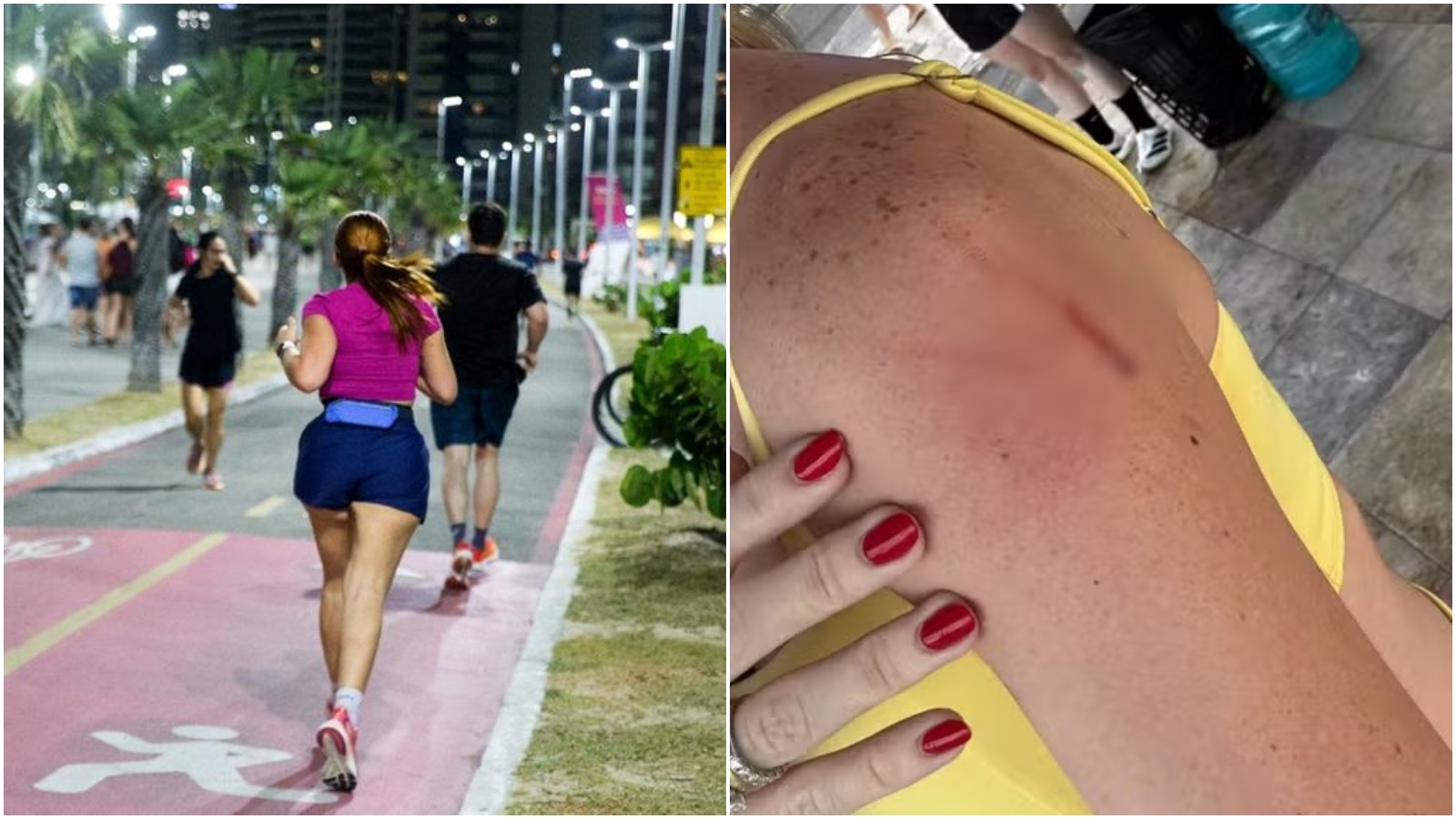 Corredoras sofrem agressões de mulher em situação de rua na Beira Mar de Fortaleza