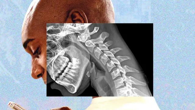 Mãos fracas e visão turva: estamos ficando com 'corpo de celular'?