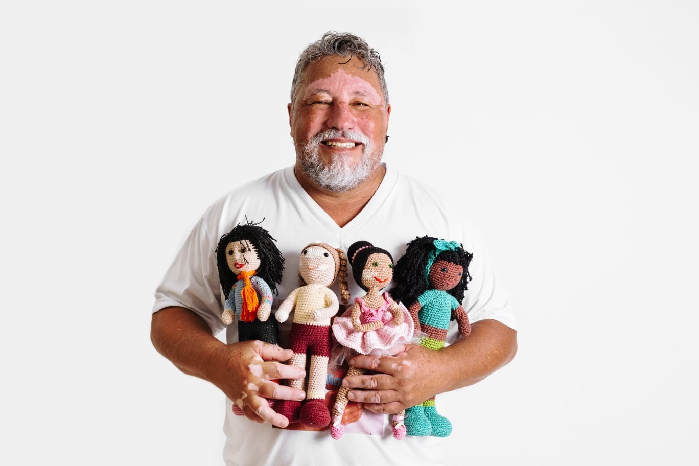 Idoso confecciona bonecas com manchas de vitiligo e faz sucesso até no exterior: ‘Levar representatividade para as crianças’