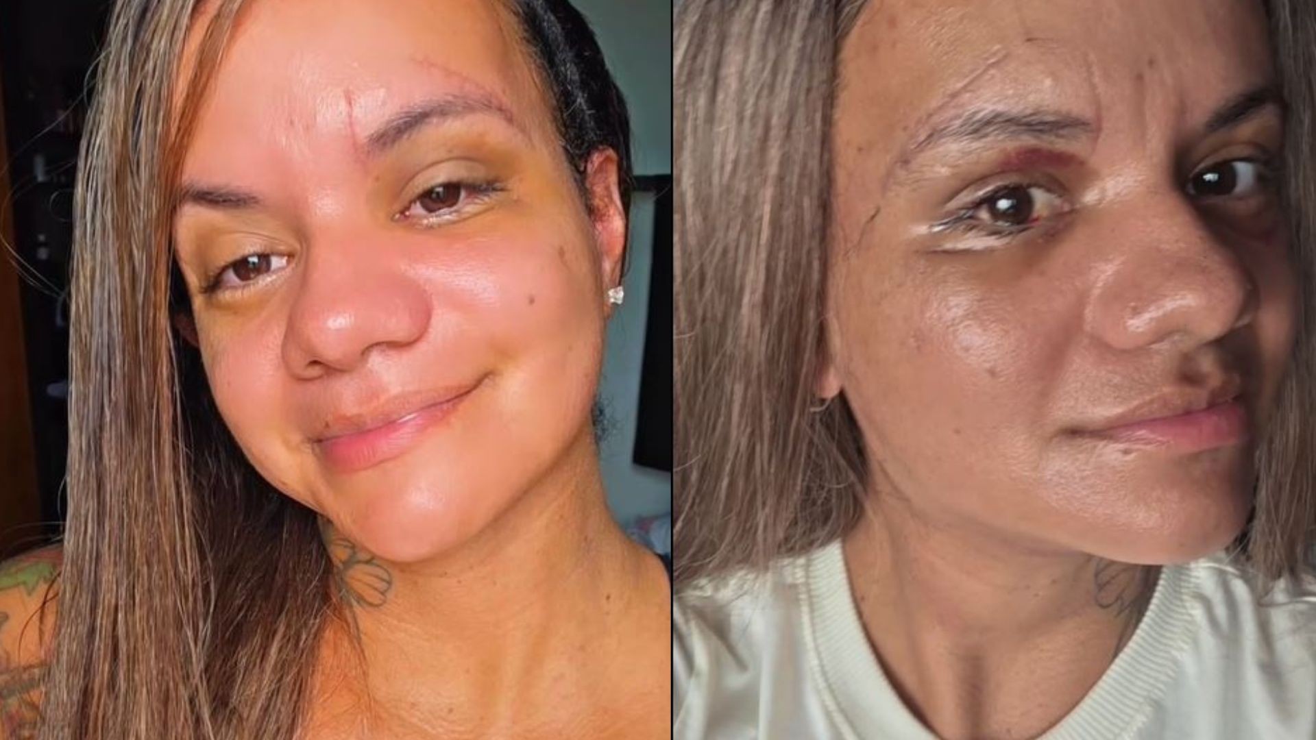 'Imensamente grata por ter minha identidade de volta', diz vítima de mais de 60 socos após cirurgia
