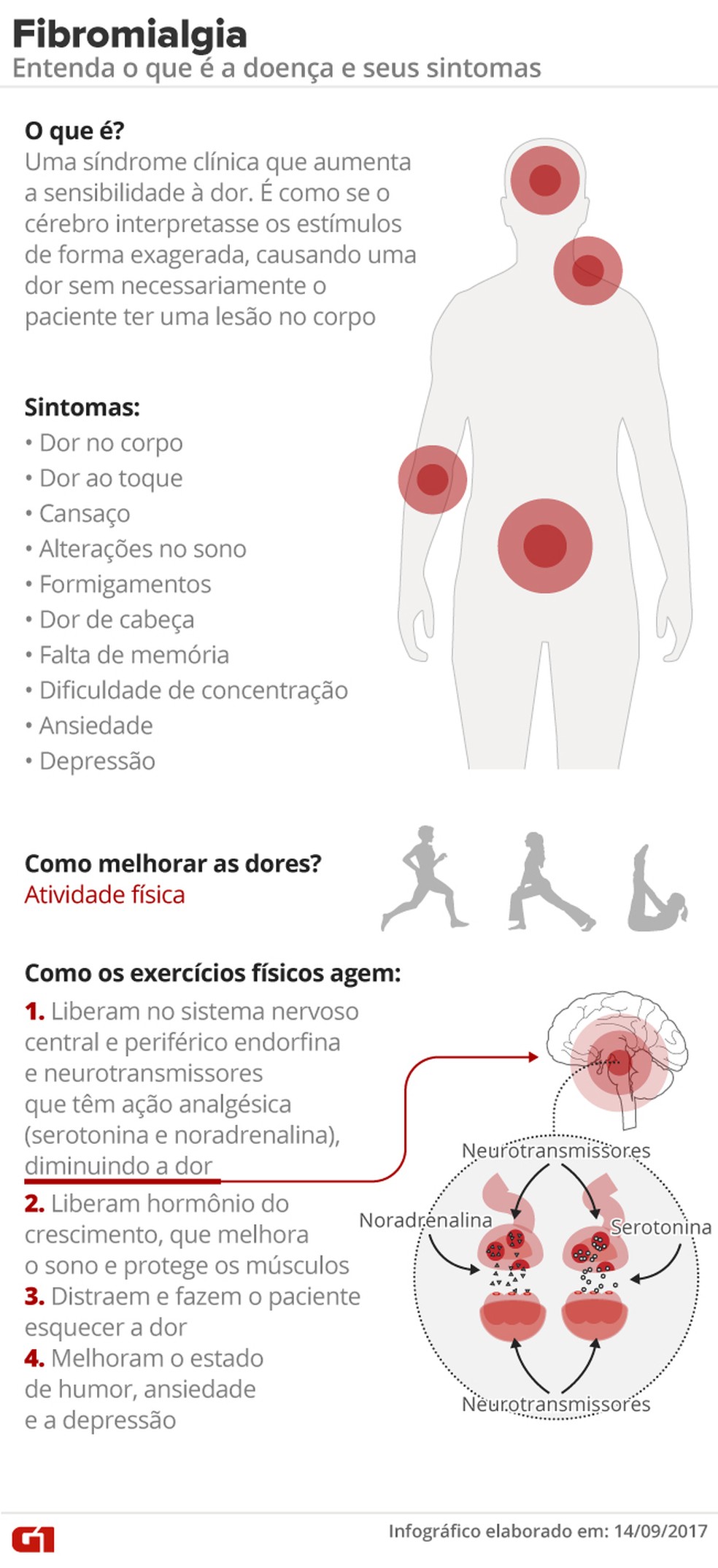 Fibromialgia — Foto: Arte/G1