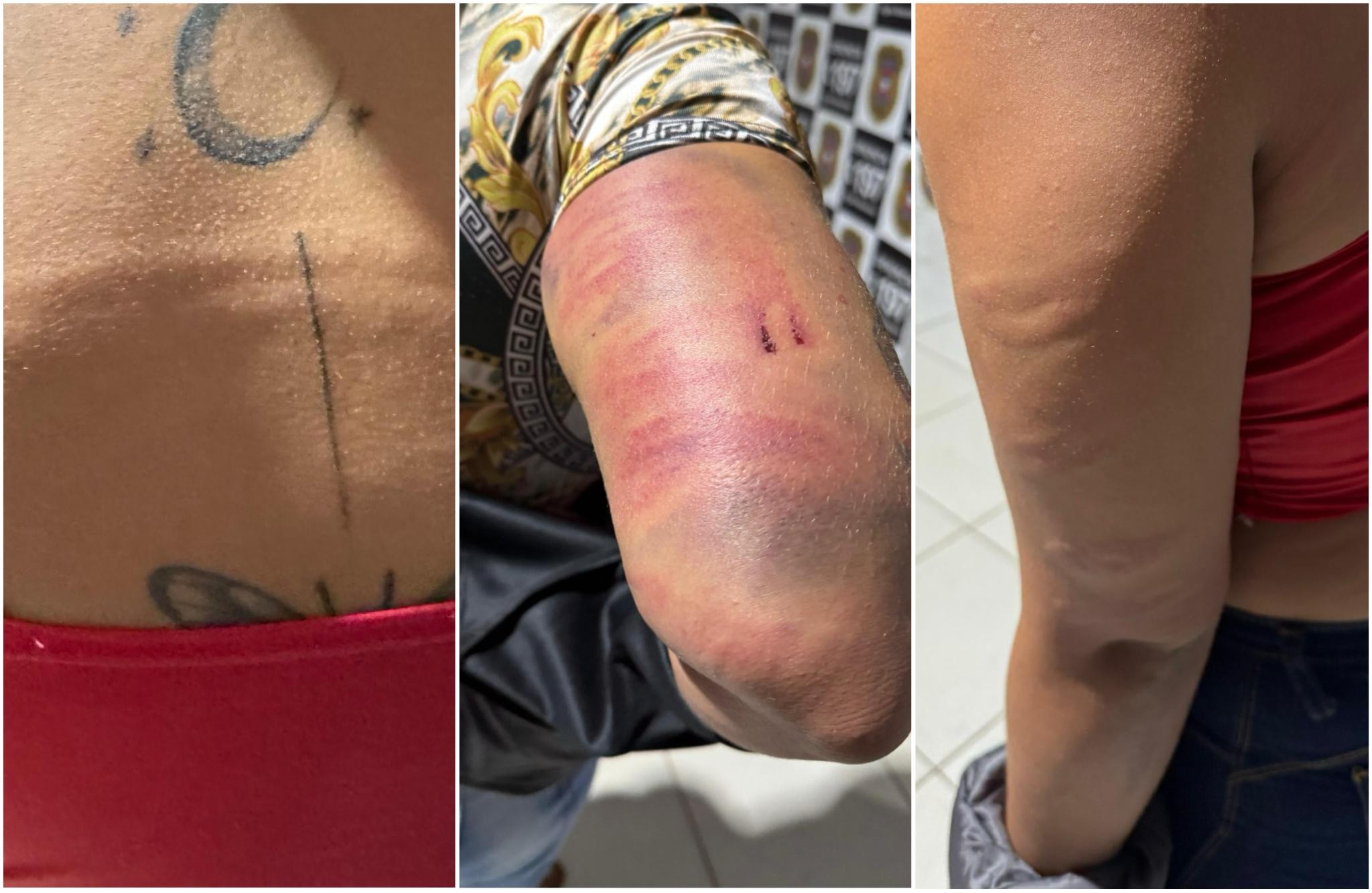 Garotas de programa são torturadas após confusão em boate de MT; vídeo