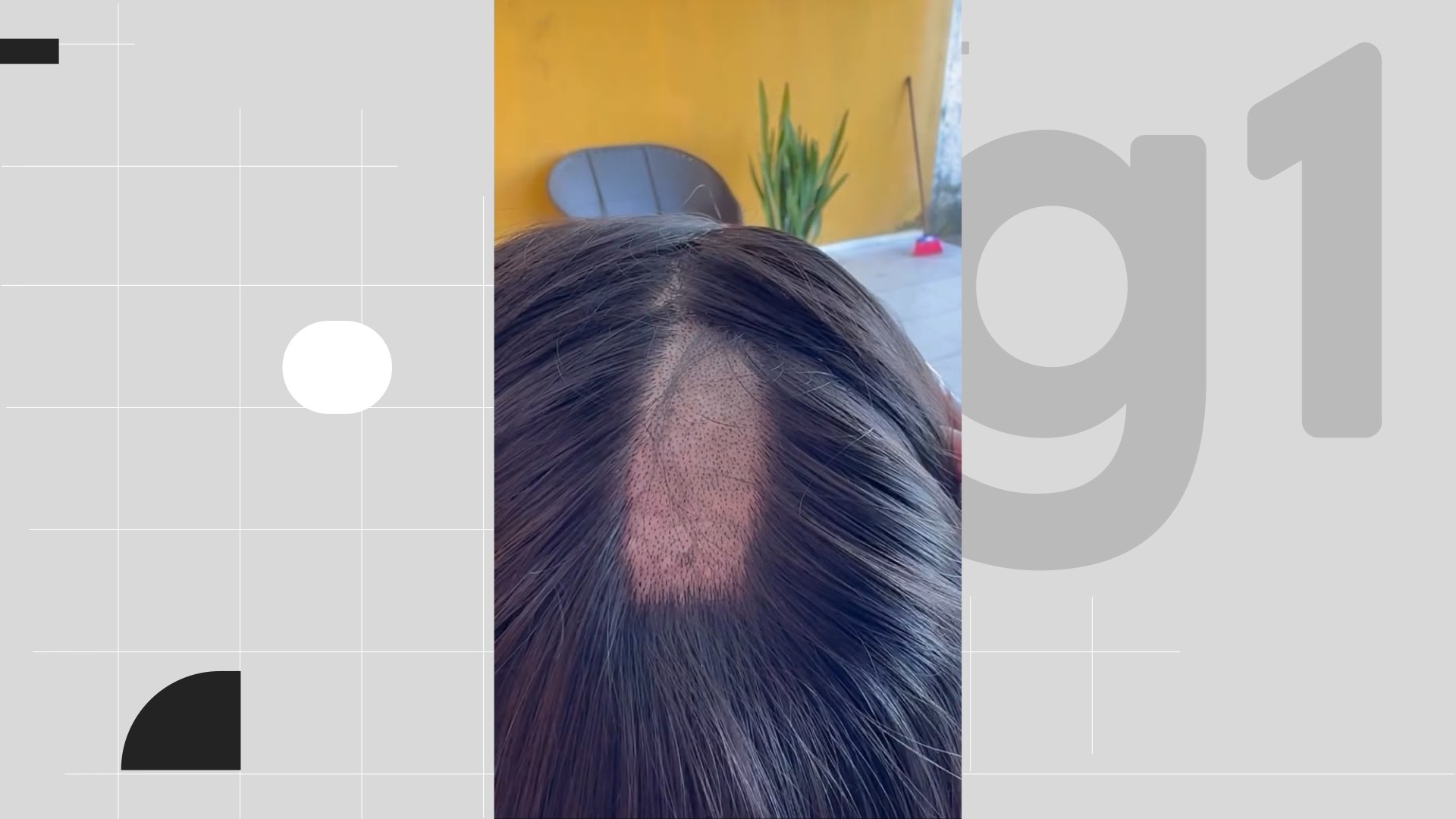 Mulher denuncia falha em exame toxicológico para CNH após ter parte da cabeça raspada em laboratório na PB; VÍDEO