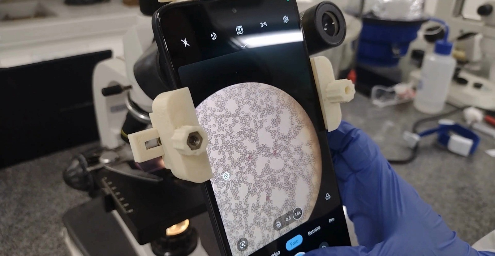 Método criado na Unicamp faz exame de sangue em 5 segundos usando smartphone e inteligência artificial