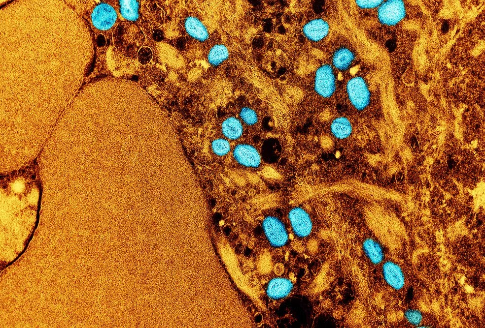 Mpox deixa de ser emergência de saúde internacional, anuncia OMS