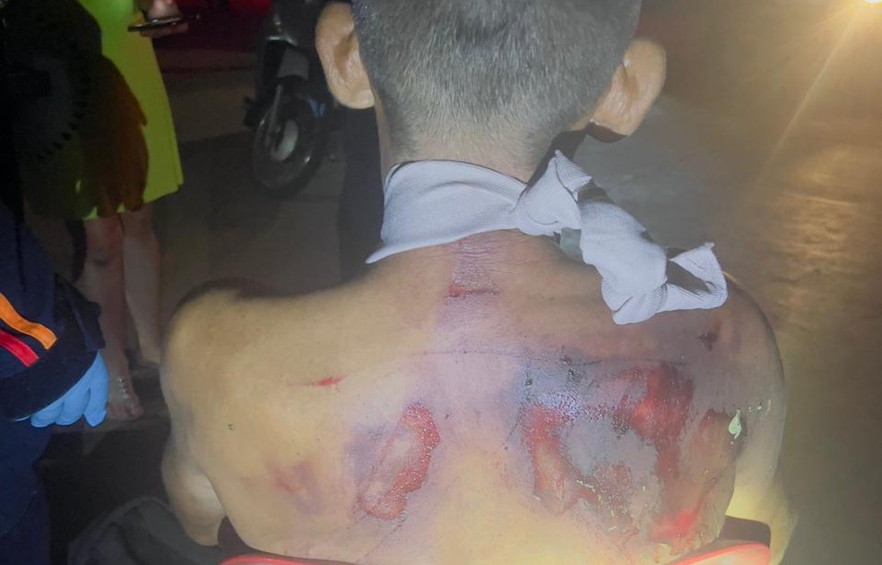 Polícia Militar afirma que homem foi ferido por indigenas em resposta aos tiros contra eles — Foto: PM/PR