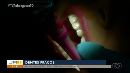 Dentista explica o que pode deixar os dentes mais fracos