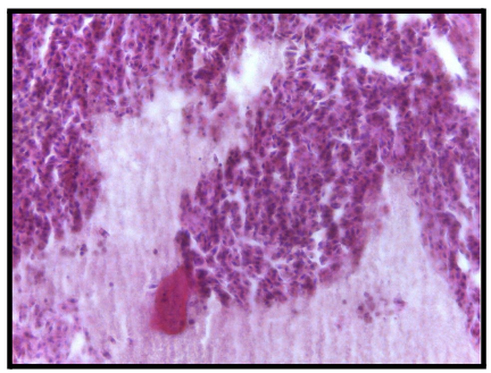 A imagem mostra o registro microscópico de uma necrose encontrada em uma das amostras coletadas. — Foto: Reprodução/UFC