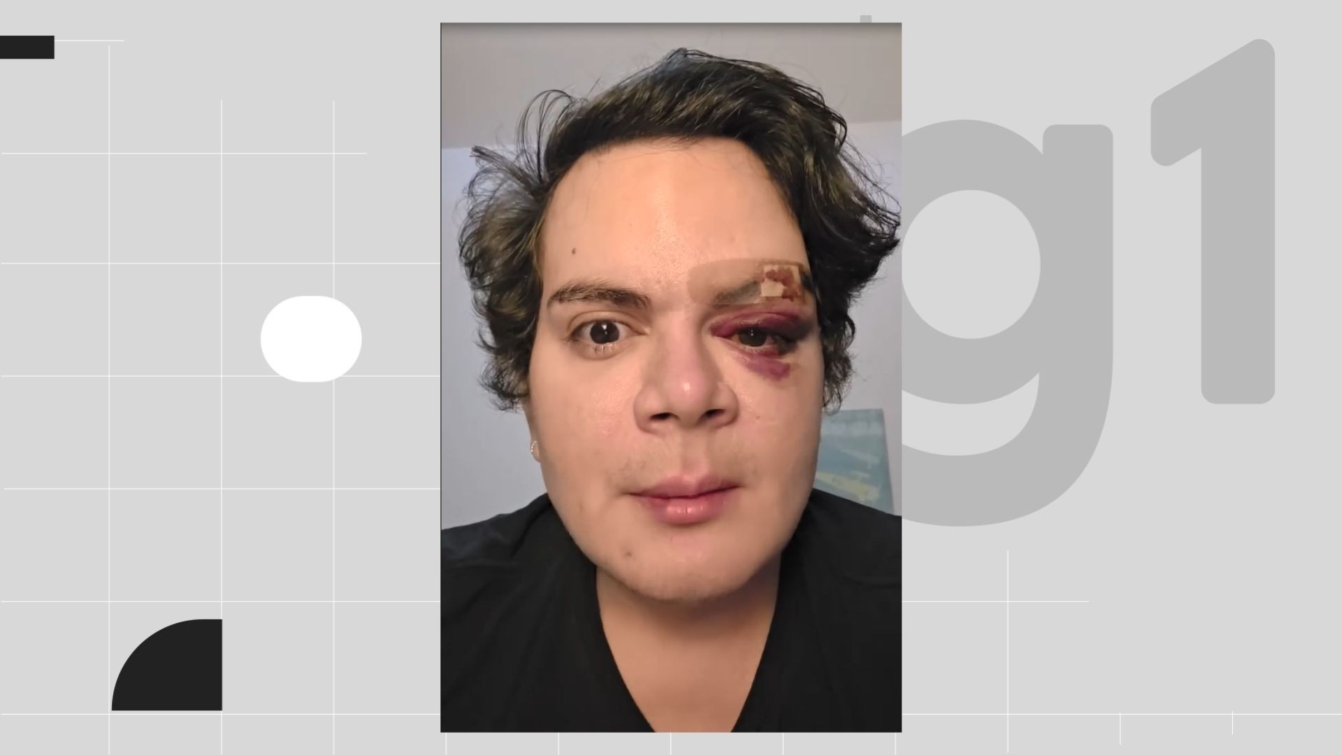 Homem é preso após invadir apartamento e agredir médico com socos e ofensas homofóbicas 