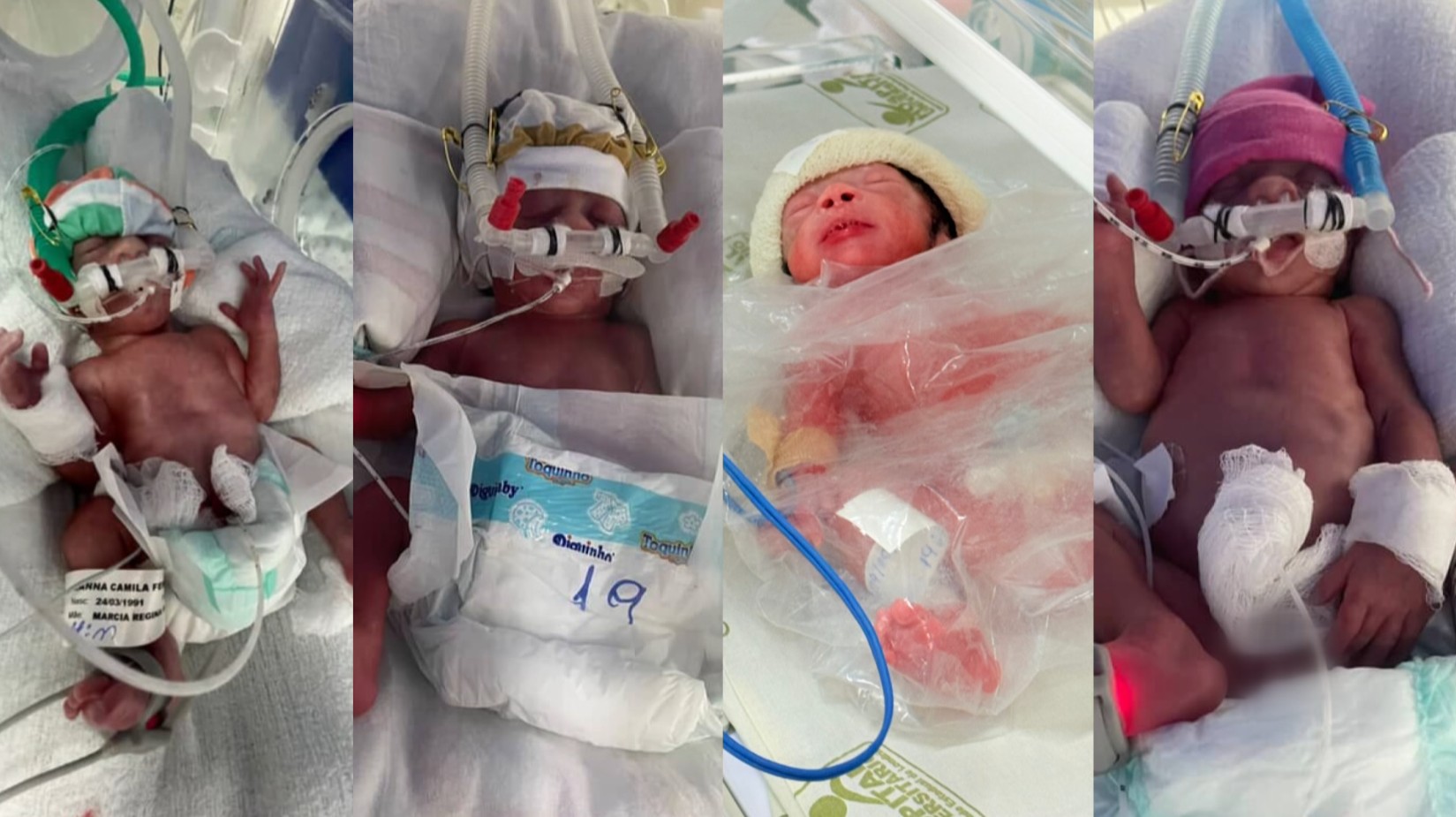 Quadrigêmeos nascem no PR após casal tentar ter filhos por quatro anos