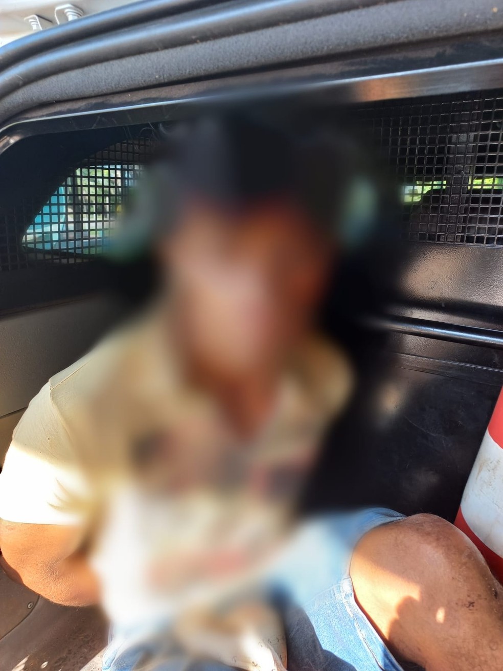 Homem de 33 anos foi preso após arrancar nariz da esposa com uma mordida — Foto: Reprodução